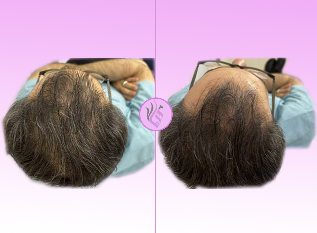 casht hair